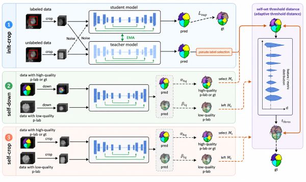 Medical image analysis framework with segmentation and organ modeling